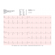 Electrocardiographe ECG Cardioline Touchecg HD+ Bluetooth (12 pistes) pour PC ou tablette Windows
