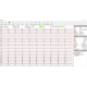 Electrocardiographe ECG Spengler Cardiomate PC-ECG (12 pistes)