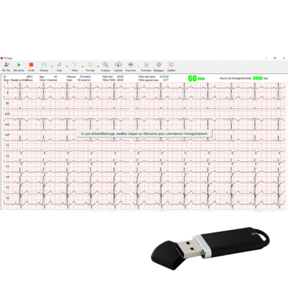 Logiciel pour ECG PC-ECG et Cardiomate 3, 6 et 12 (avec clé physique) Spengler
