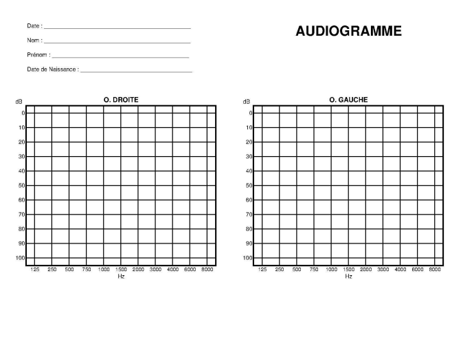 Exemple d'audiogramme