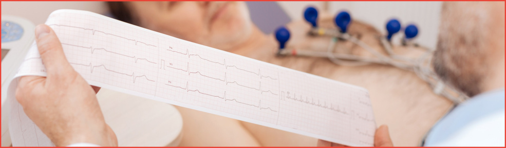 ECG